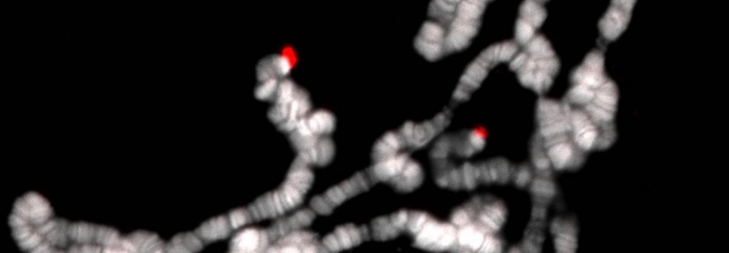 telomeres